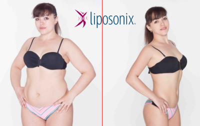 Liposonix III. celé postavy