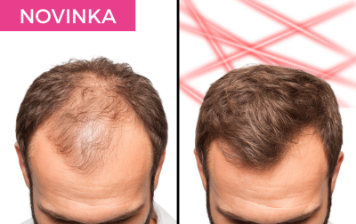 Revoluční laserová obnova vlasů